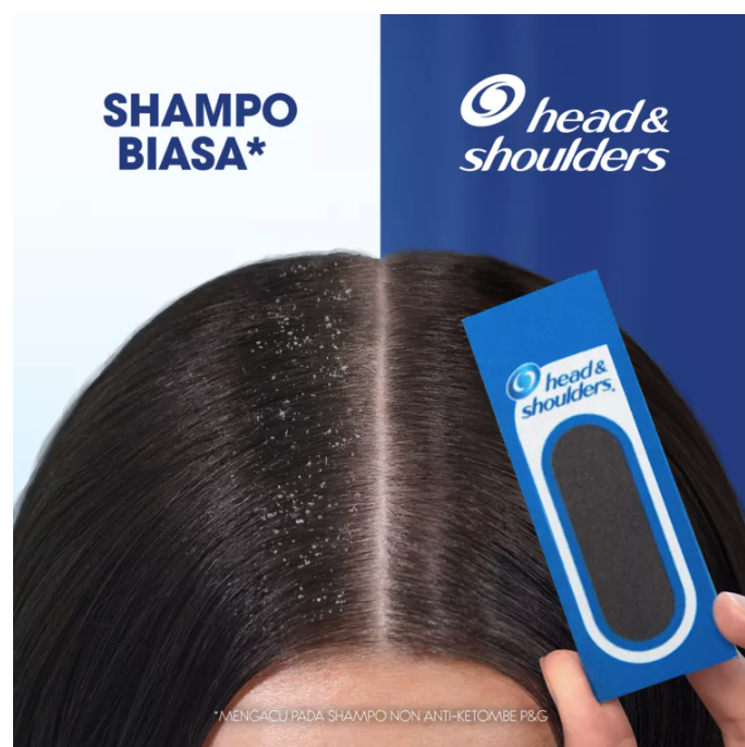 Smooth & Silky Anti-Dandruff Shampoo 4