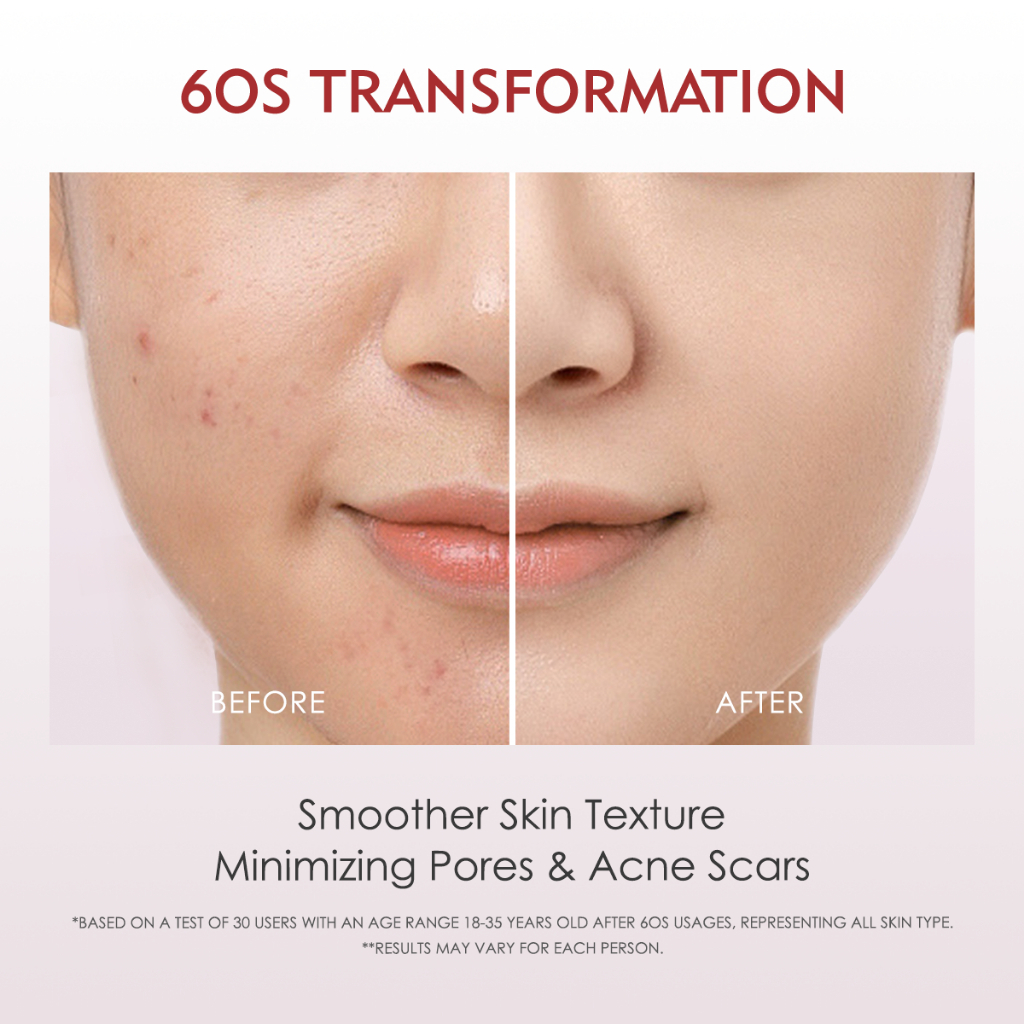 Nayue Kosmetik Indonesia ELFORMULA Intensive Peeling Solution 