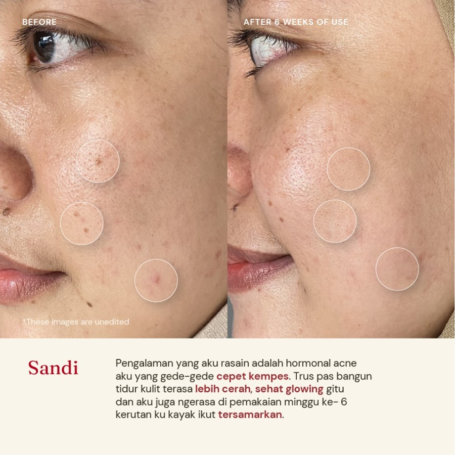 Pillar Brite Care For Skin's Sake Retinol Cream 0.1% with Polyglutamic Acid