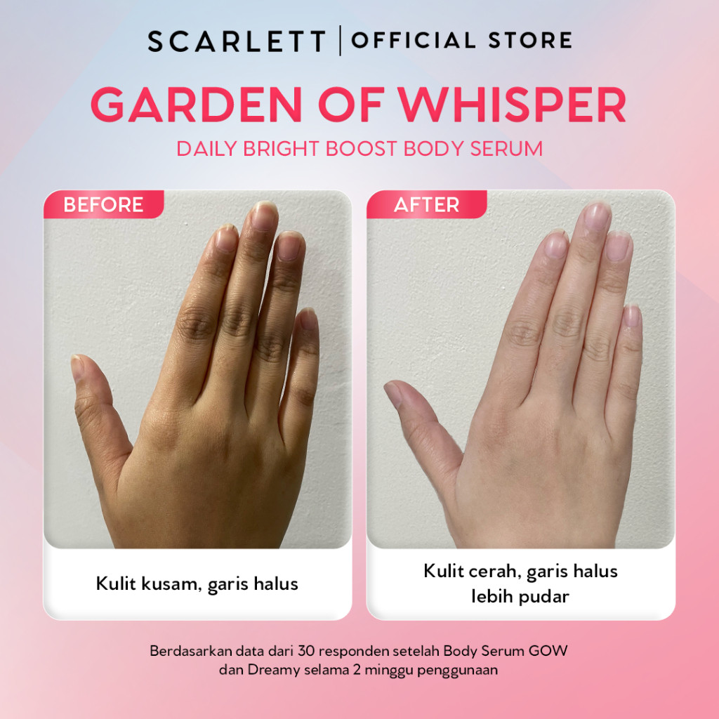 Garden of Whisper Glucinamide™ Alpha Arbutin 5