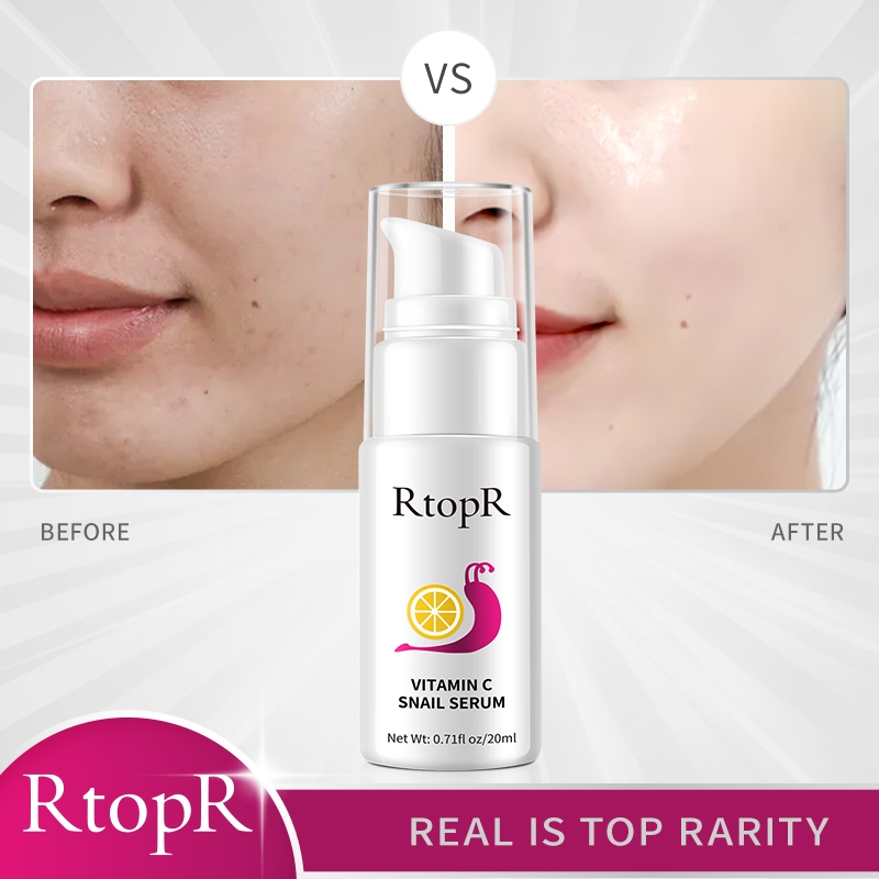  RtopR Vitamin C + Snail Serum