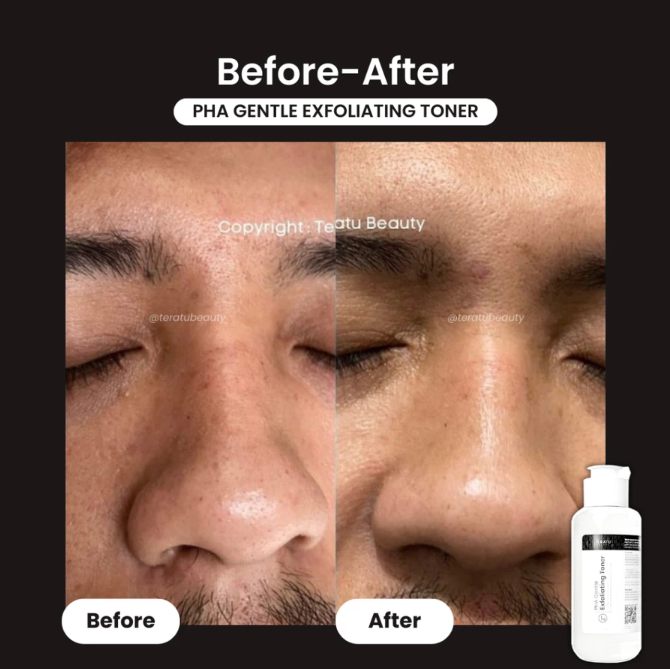 Fandi Universal Kosmekreasi Tératu Beauty PHA Gentle Exfoliating Toner