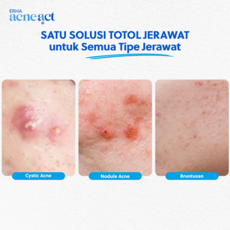 ERHA Acneact Acne Spot Gel