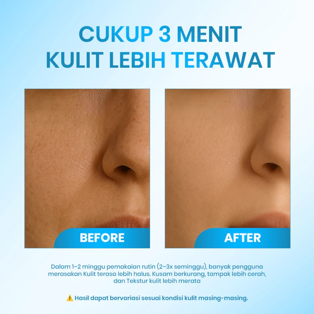 Cleora Beauty Solution Cleora 3 Minutes Exfoliating Peeling Gel