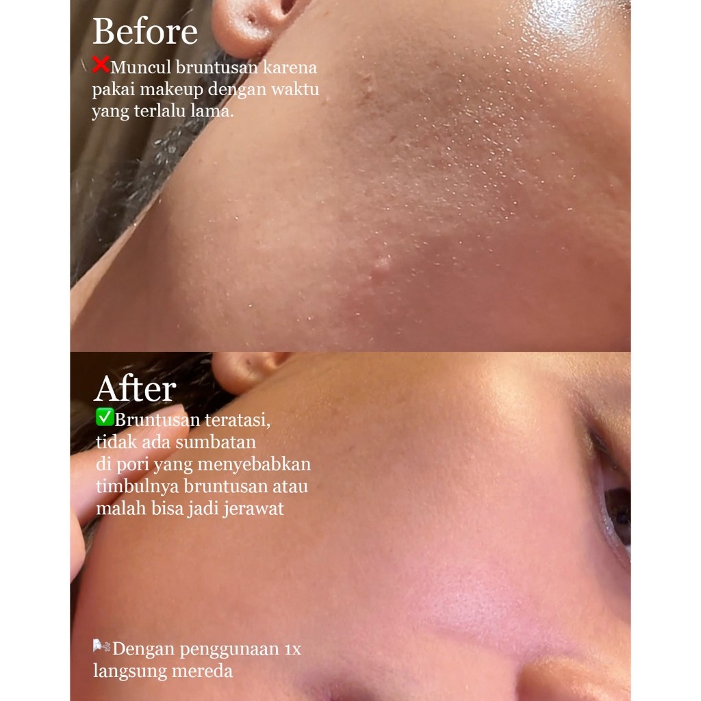 The Aubree  The Aubree Acid Mix Exfoliating Toner