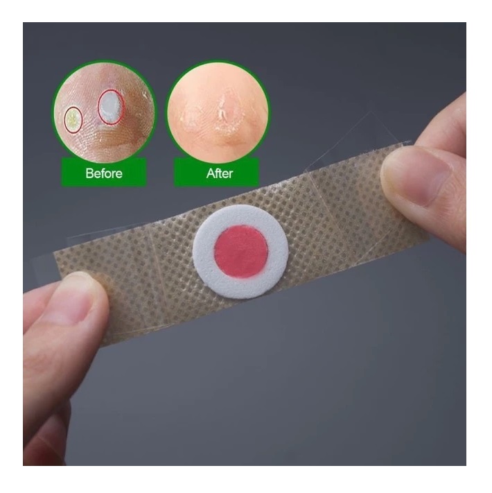  Sumifun Foot Corn Removal Plaster