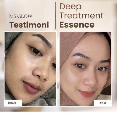 Kosmetika Cantik Indonesia MS Glow Deep Treatment Essence Salmon DNA