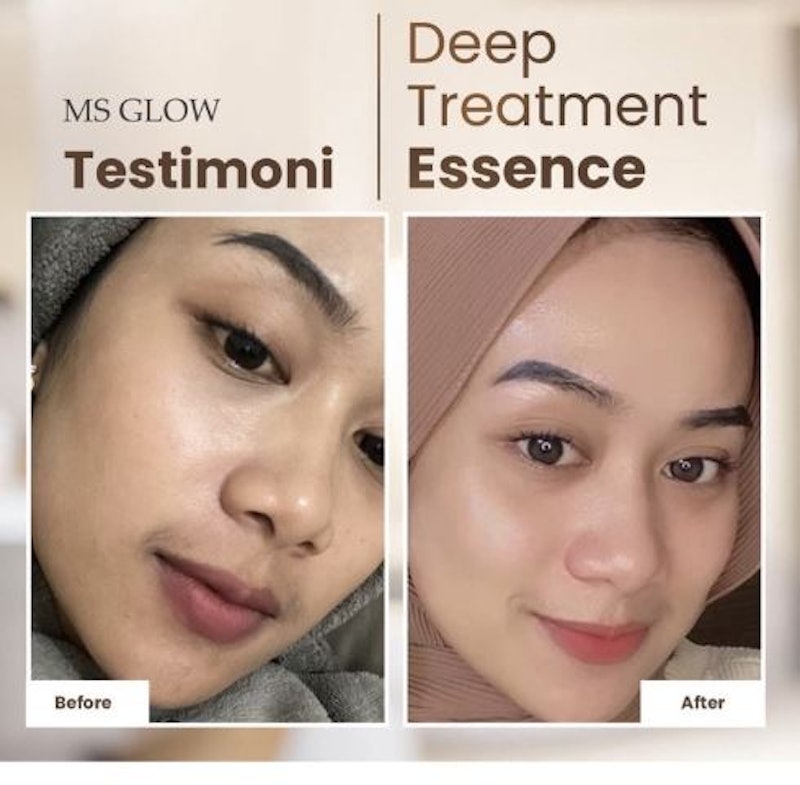 MS Glow Deep Treatment Essence Salmon DNA 4