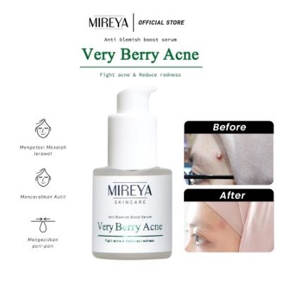 Indokarisma Parvaiz Makmur Mireya Very Berry Acne Anti Blemish Boost Serum