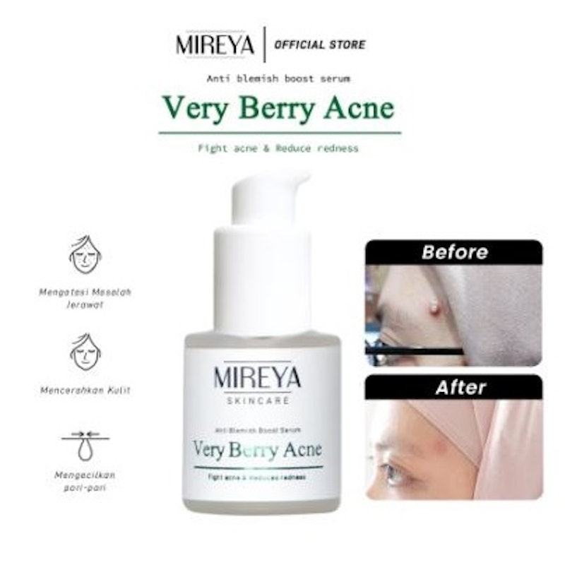 Mireya Very Berry Acne Anti Blemish Boost Serum 3