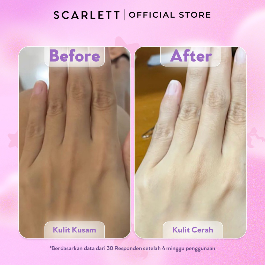 Opto Lingkar Sejahtera Scarlett Whitening Fragrance Brightening Body Serum Velvet Rouge