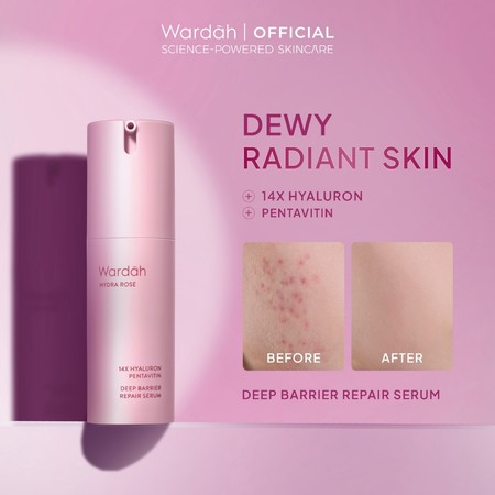 Paragon Technology and Innovation Wardah Hydra Rose 14X Hyaluronic Pentavitin Deep Barrier Repair Serum 