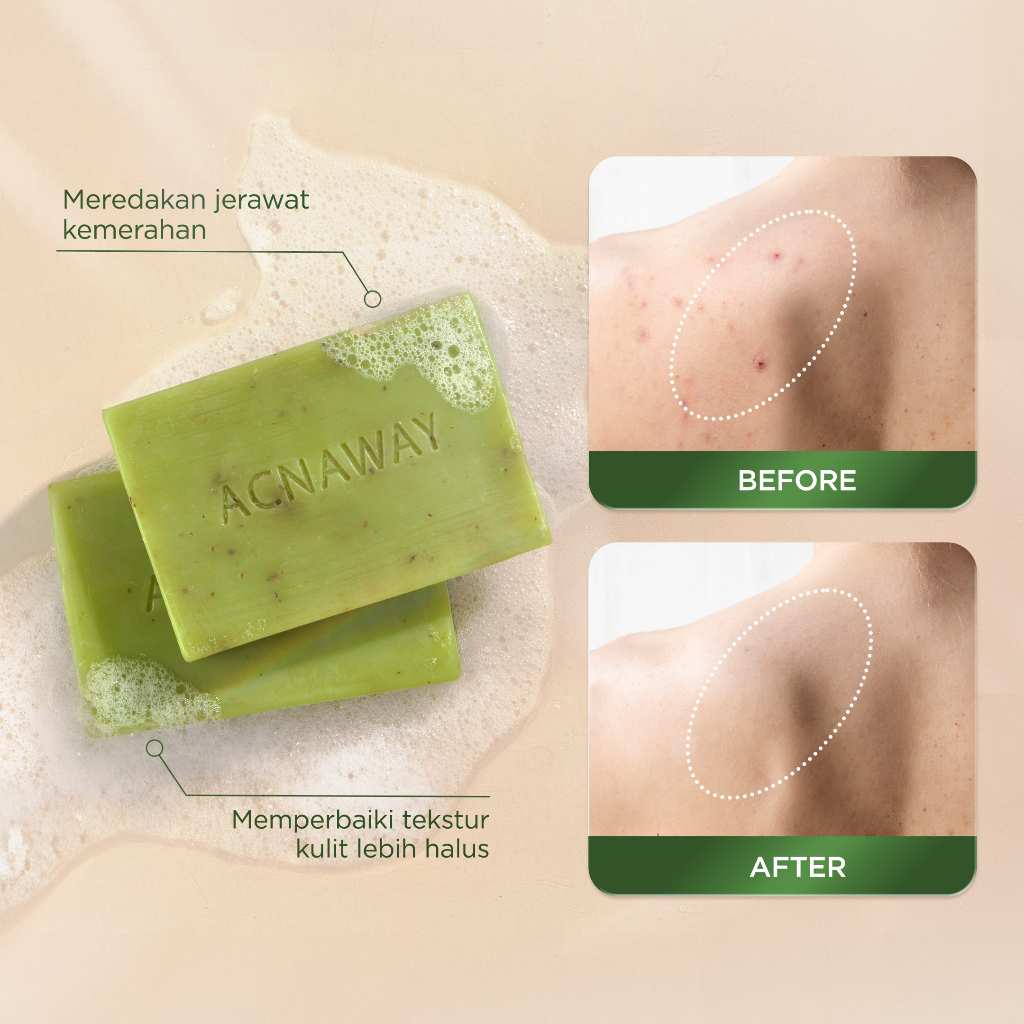  ACNAWAY Mugwort Acne Clear Bar Soap