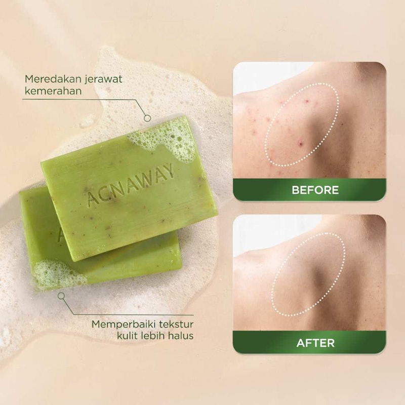 ACNAWAY Mugwort Acne Clear Bar Soap 5
