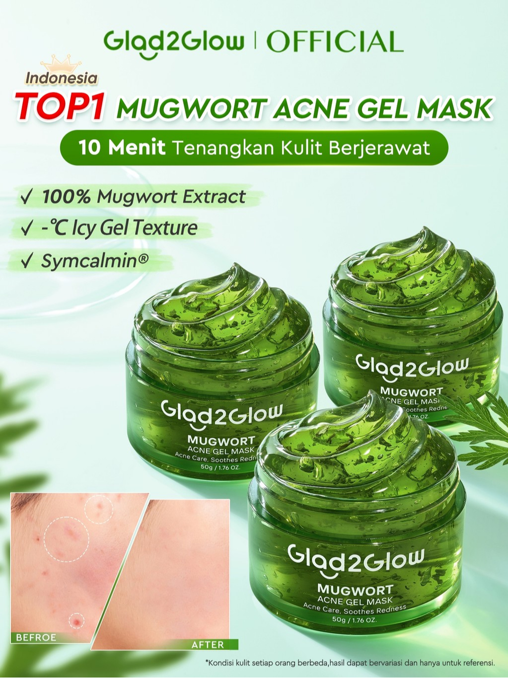 Suntone Wisdom Indonesia Glad2Glow Advanced Mugwort Acne Gel Mask