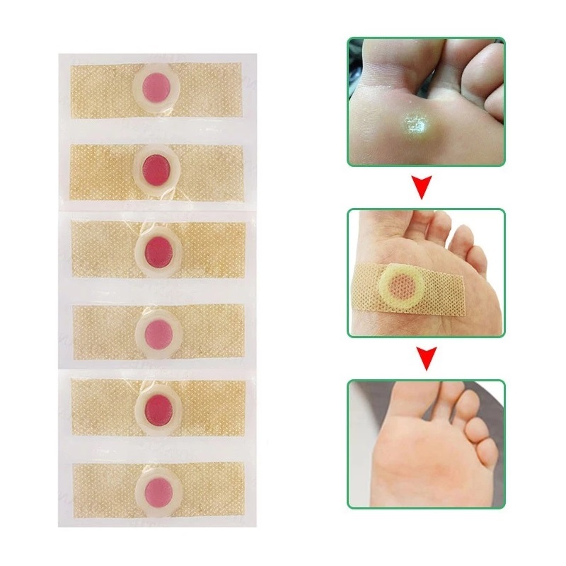  Sumifun Foot Corn Removal Plaster