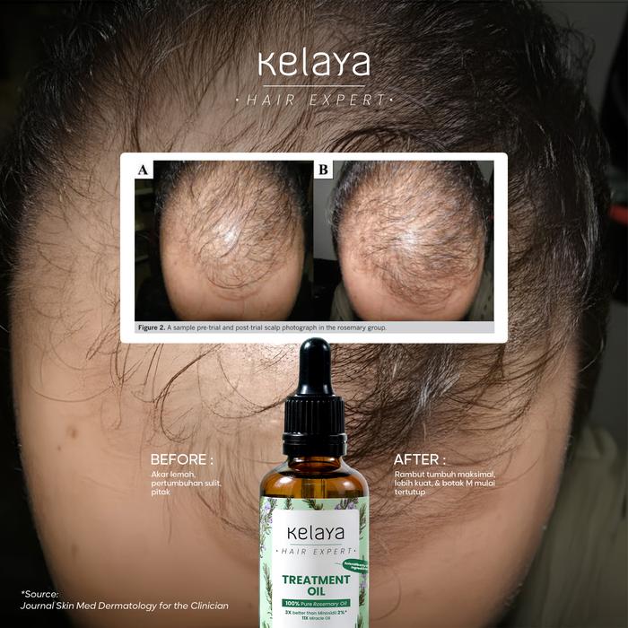 Kelaya Hair Expert Treatment Oil 3