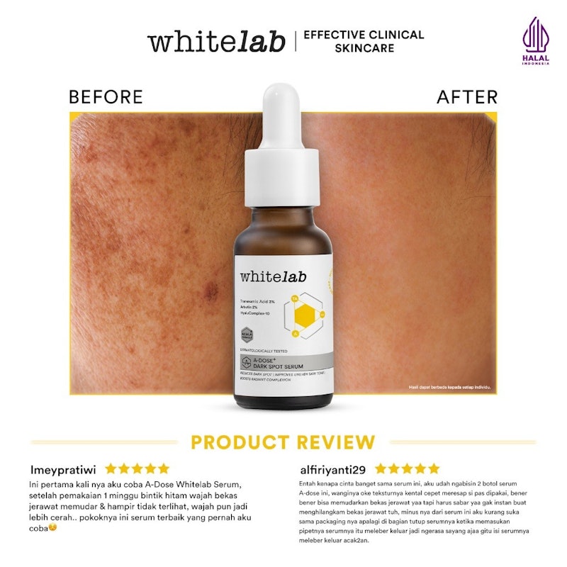 A-Dose+ Dark Spot Serum 3