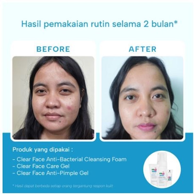 Sebamed Clear Face Antibacterial Cleansing Foam 3