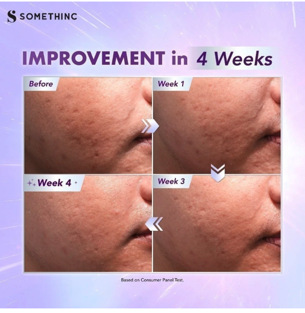 Royal Pesona Indonesia SOMETHINC BioSpicule Renewal Serum (Mild)