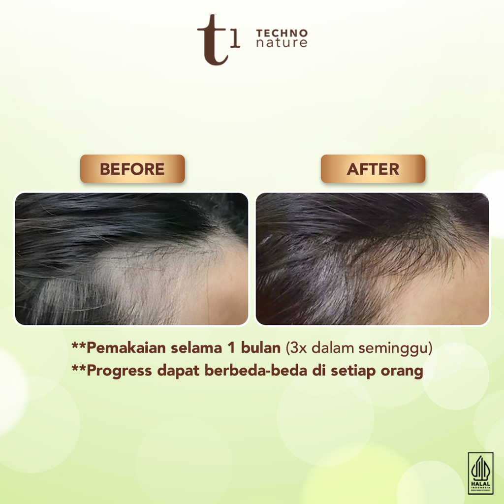 Akasha Wira International MAKARIZO T1 Techno Nature Scalp & Hair Oil with Rosemary Oil