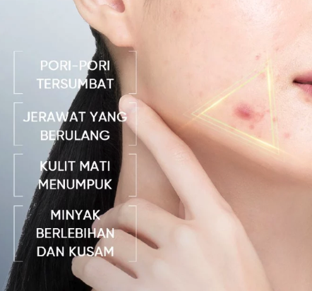 SKINTIFIC Cosmetics SKINTIFIC 3X Acid Anti-Acne Gel Moisturizer