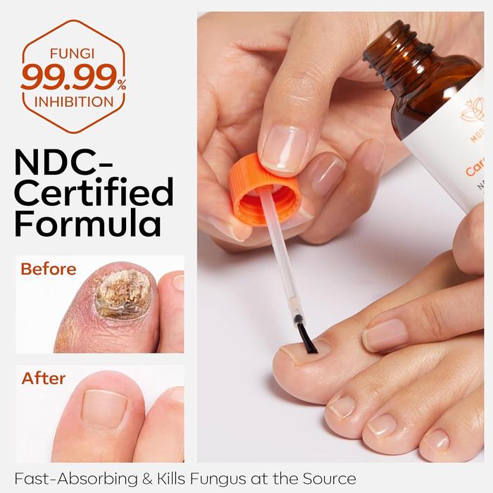 MODELONES  MODELONES Nail Antifungal Treatment