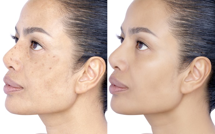 Untuk menyamarkan flek hitam atau bekas jerawat, utamakan foundation dengan medium atau medium buildable coverage