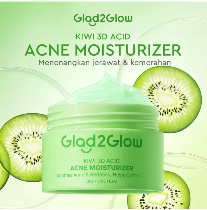 Anda memiliki kulit berminyak dan berjerawat? Cek Glad2Glow Kiwi 3D Acid Acne Moisturizer (kemasan hijau)
