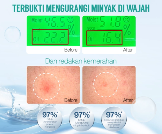 Pastikan bahan tambahannya sesuai jenis kulit: Kandungan oil-control untuk kulit berminyak dan pelembap untuk kulit kering