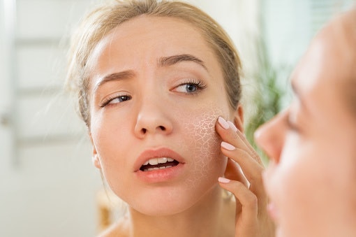 Untuk kulit sensitif, pertimbangkan toner dengan formula gentle dan mengandung soothing agent; seperti Aloe vera, tea tree, niacinamide, dan Centella asiatica