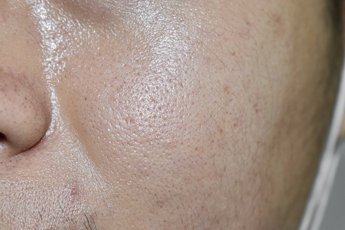 Untuk kulit yang berminyak, pilih pelembap water based yang mengandung bahan salicylic acid atau niacinamide
