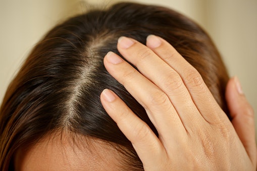 Untuk kulit kepala kering, pilih scalp shampoo yang kaya akan pelembap