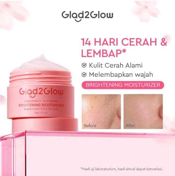 Untuk kulit kusam, pilih moisturizer Glad2Glow Pomegranate 5% Niacinamide Brightening Moisturizer (kemasan pink)