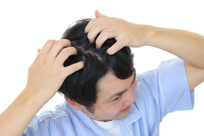 Atasi rambut berketombe dan kepala gatal dengan CLEAR Ice Cool Menthol atau CLEAR Complete Soft Care