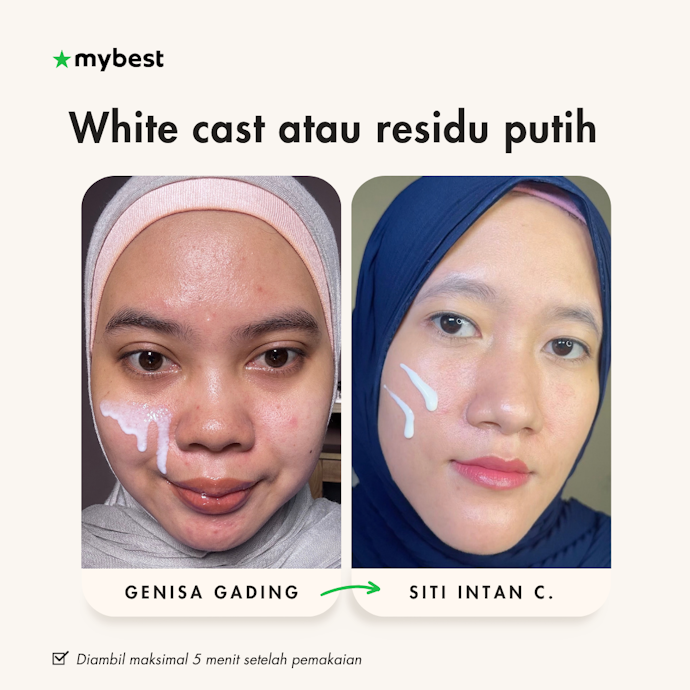 White cast atau residu putih