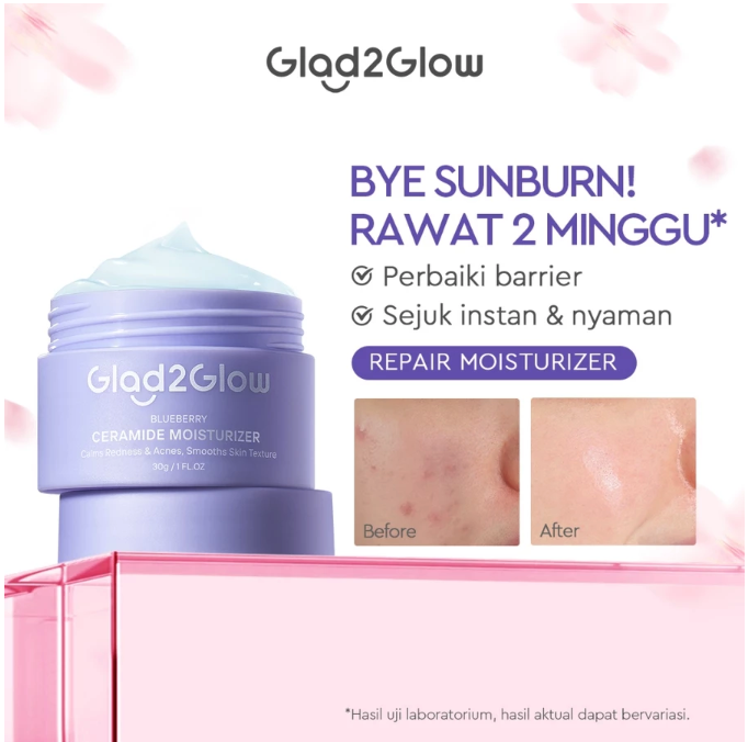 Untuk menjaga kelembapan kulit kering dan sensitif, utamakan Glad2Glow Blueberry Ceramide Moisturizer (kemasan ungu) atau Glad2Glow Tremella Vita B5 (kemasan biru)