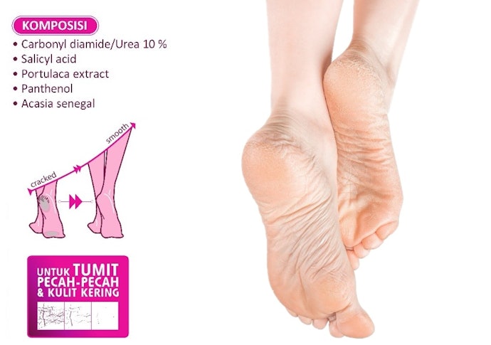 Untuk mengatasi penebalan pada kaki yang pecah-pecah, cari cream dengan bahan eksfolian, seperti salicylic acid atau lactic acid