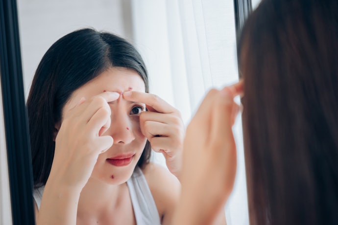 Jika kulit sedang berjerawat, pilih masker Korea yang mengandung soothing agent dan antibakteri