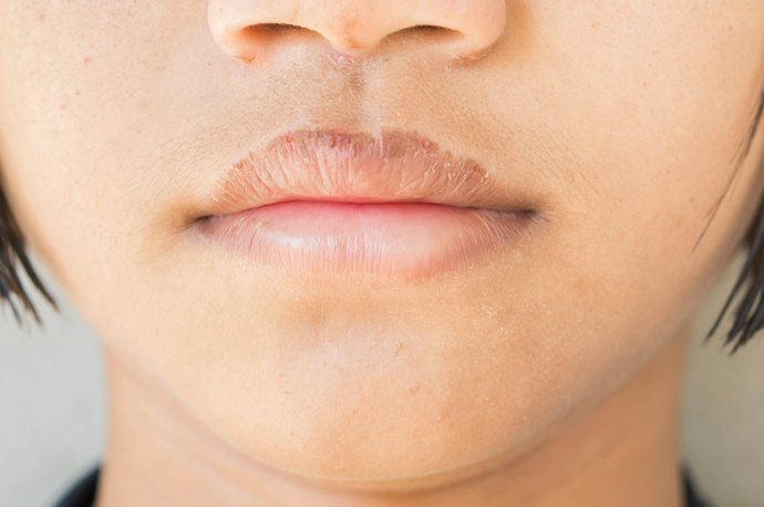 Untuk bibir kering, pilih lip serum yang mengandung tiga jenis pelembap