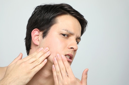 Sebaliknya, bila kulit Anda kering, pilih hydrating toner rendah alkohol yang mengandung gliserin, ceramide, atau hyaluronic acid
