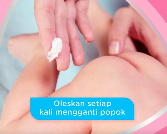 Utamakan salep bertekstur krim karena cocok untuk berbagai kondisi kulit bayi dan anak