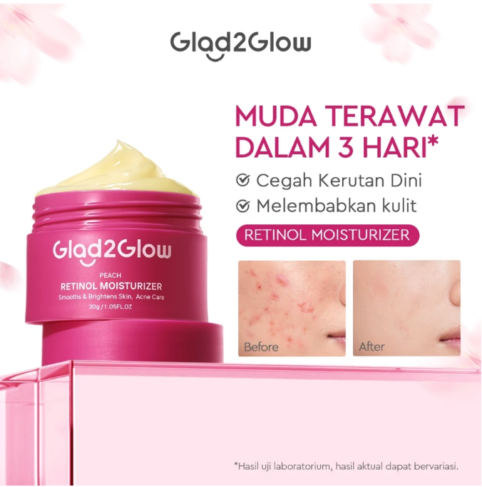 Untuk kulit yang mulai mengalami tanda-tanda penuaan seperti garis halus, gunakan Glad2Glow Peach Retinol Moisturizer (kemasan merah)