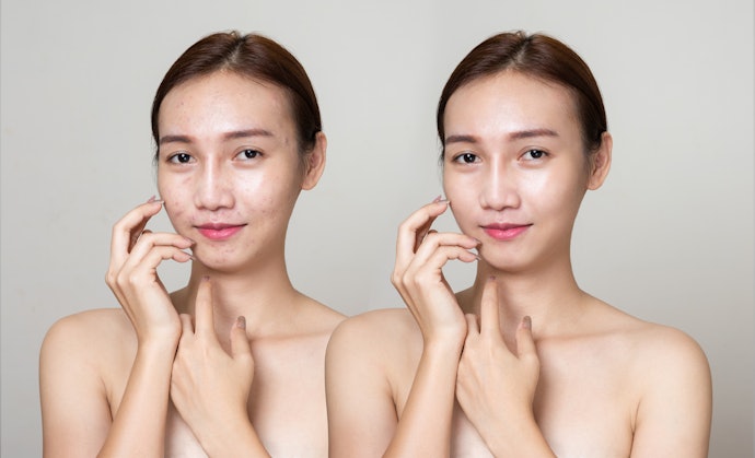Cari produk dengan medium atau medium buildable coverage untuk menutupi ketidaksempurnaan kulit
