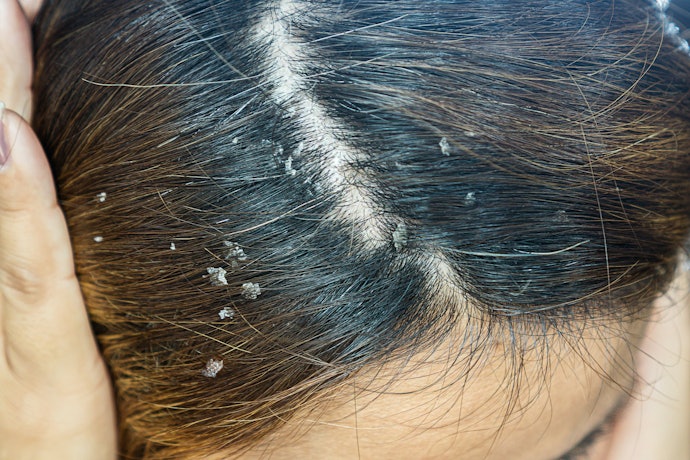 Untuk kulit kepala berminyak dan berketombe, pilih shampoo organik dengan kandungan piroctone olamine dan zinc pyrithione; Bila tidak ada, bisa pilih kandungan rosemary