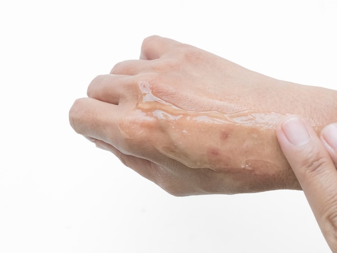 Untuk bekas luka menghitam atau hiperpigmentasi, pilih salep yang mengandung pencerah, seperti vitamin C atau alpha arbutin