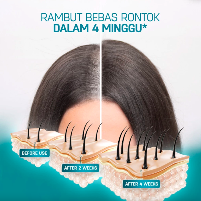 Untuk rambut rontok dan ketombe, pilih yang mengandung zinc atau niacinamide