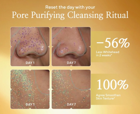 Khusus untuk kulit berminyak dan berjerawat, prioritaskan plant oils non-comedogenic