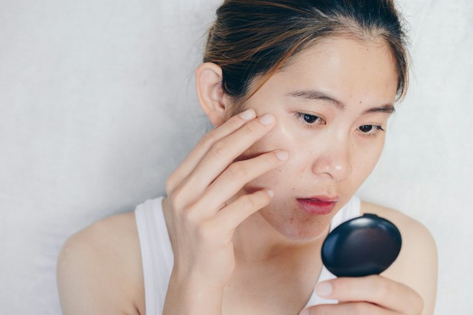 Jika kulit Anda berminyak, pilih serum bakuchiol dengan kandungan oil control dan pelembap