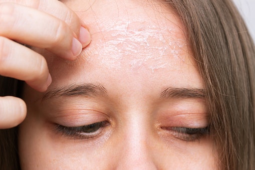 Untuk kulit kering, temukan sabun zaitun yang dilengkapi kandungan pelembap, seperti buah tin, goat milk, Aloe vera, dan collagen